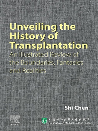 Unveiling the History of Transplantation