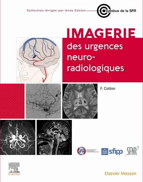Imagerie des urgences neuroradiologiques -  Francois Cotton