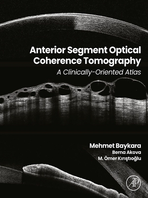 Anterior Segment Optical Coherence Tomography - 