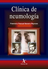 Cl&iacute;nica de neumolog&iacute;a - Francisco Pascual Navarro Reynoso