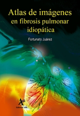 Atlas de im&aacute;genes en fibrosis pulmonar idiop&aacute;tica -  Fortunato Ju&aacute;rez Hern&aacute;ndez