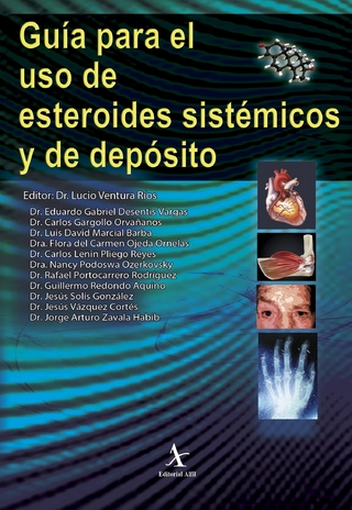 Guía para el uso de esteroides sistémicos y de depósito