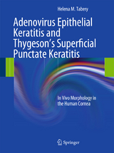 Adenovirus Epithelial Keratitis and Thygeson's Superficial Punctate Keratitis - Helena M. Tabery