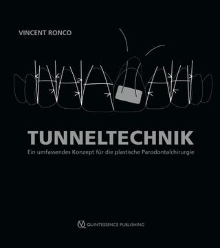 Tunneltechnik