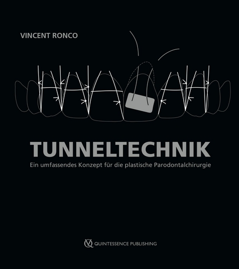 Tunneltechnik -  Vincent Ronco