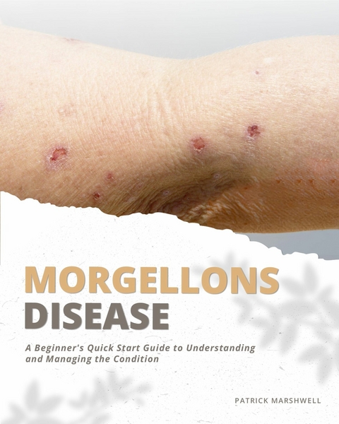Morgellons Disease -  Patrick Marshwell
