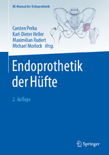 Endoprothetik der H&uuml;fte - 