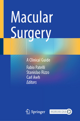Macular Surgery - 