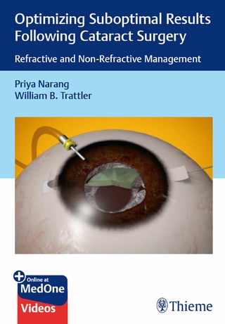 Optimizing Suboptimal Results Following Cataract Surgery