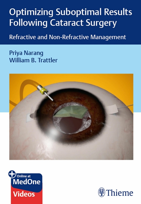Optimizing Suboptimal Results Following Cataract Surgery - Priya Narang, William B. Trattler