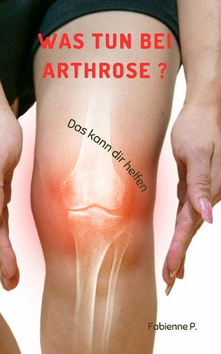 Was tun bei Arthrose ?