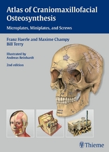 Atlas of Craniomaxillofacial Osteosynthesis - Franz H&auml;rle, Maxime Champy, Bill Terry