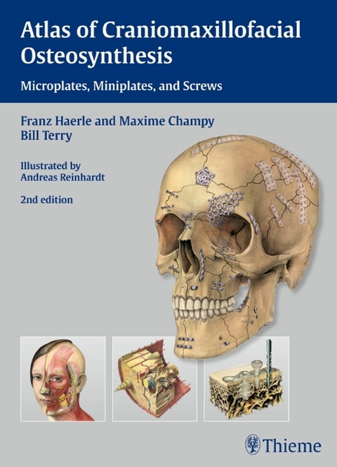 Atlas of Craniomaxillofacial Osteosynthesis - Franz H&auml;rle, Maxime Champy, Bill Terry
