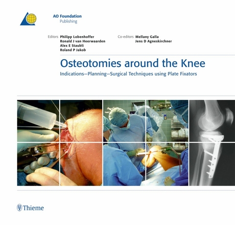 Osteotomies around the Knee -  Philipp Lobenhoffer,  Ronald J. van Heerwaarden,  Alex E. Staubli,  Roland P. Jakob