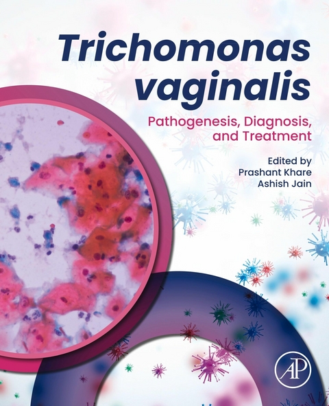 Trichomonas vaginalis - 