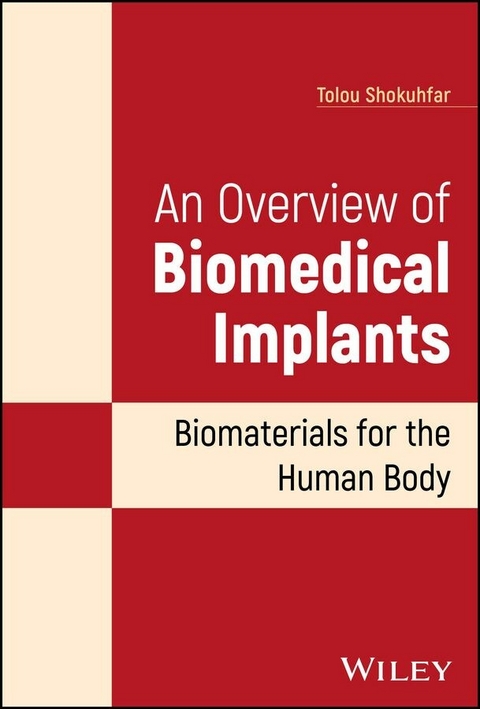 An Overview of Biomedical Implants - Tolou Shokuhfar