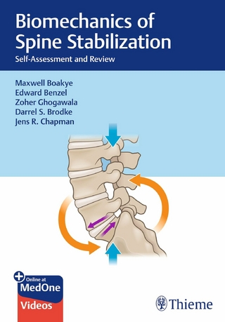 Biomechanics of Spine Stabilization