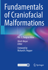 Fundamentals of Craniofacial Malformations - 
