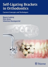 Self-ligating Brackets in Orthodontics - Bj&ouml;rn Ludwig, Dirk Bister, Sebastian Baumgaertel