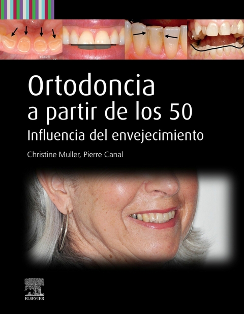 Ortodoncia a partir de los 50 -  Pierre Canal,  Christine Muller