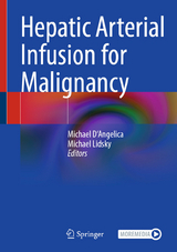 Hepatic Arterial Infusion for Malignancy - 