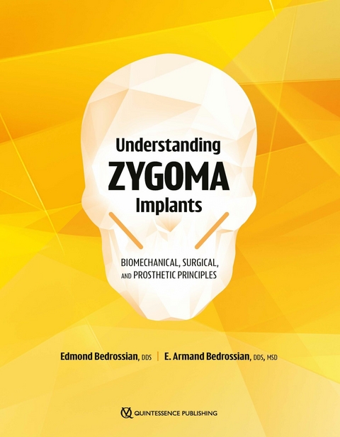 Understanding Zygoma Implants - Edmond Bedrossian, E. Armand Bedrossian