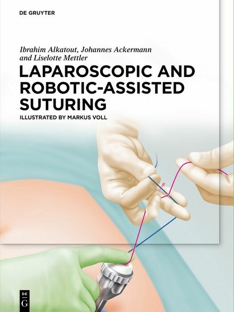 Laparoscopic and Robotic-Assisted Suturing -  Ibrahim Alkatout,  M. A.,  Johannes Ackermann,  M. D.,  Liselotte Mettler