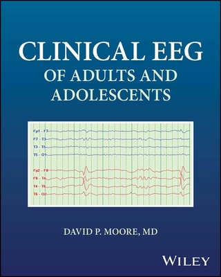 Clinical EEG of Adults and Adolescents