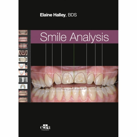 Smile Analysis -  Elaine Halley