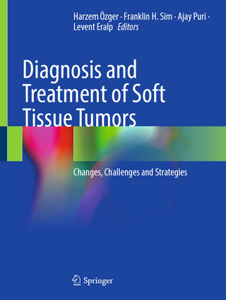 Diagnosis and Treatment of Soft Tissue Tumors