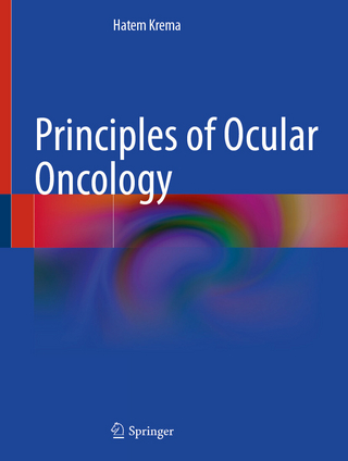 Principles of Ocular Oncology