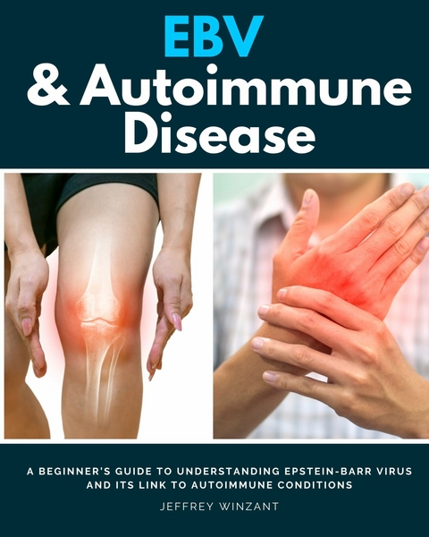 EBV & Autoimmune Disease -  Jeffrey Winzant