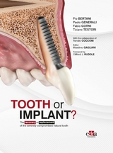 Tooth or Implant? -  Pio Bertani