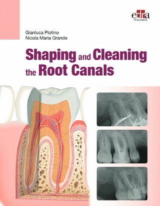Shaping and  Cleaning the Root Canals