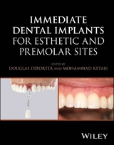 Immediate Dental Implants for Esthetic and Premolar Sites - 