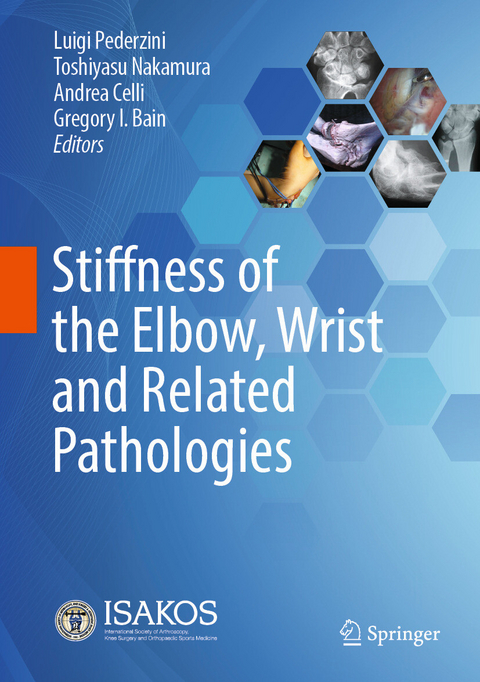 Stiffness of the Elbow, Wrist and Related Pathologies - 