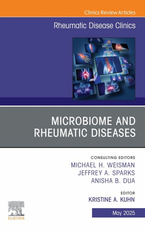 Microbiome and Rheumatic Diseases, An Issue of Rheumatic Disease Clinics of North America - 