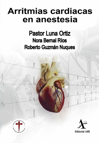 Arritmias cardiacas en anestesia