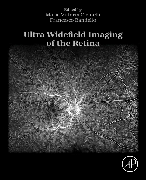 Ultra Widefield Imaging of the Retina - 