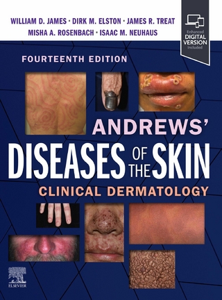 Andrews' Diseases of the Skin E-Book