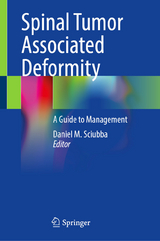 Spinal Tumor Associated Deformity - 