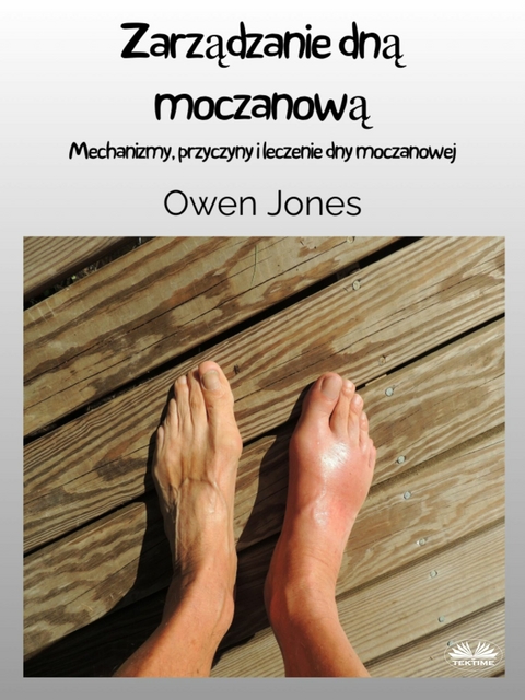 Zarządzanie Dną Moczanową -  Owen Jones