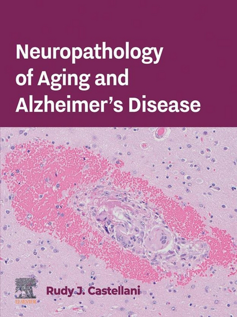 Neuropathology of Aging and Alzheimer's Disease -  Rudy J. Castellani