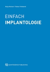 Einfach Implantologie - 