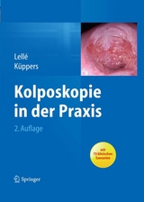 Kolposkopie in der Praxis - Ralph J. Lell&eacute;, Volkmar K&uuml;ppers