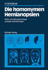 Die homonymen Hemianopsien - Hans W. K&ouml;lmel
