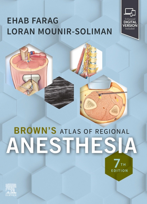 Brown's Atlas of Regional Anesthesia, E-Book - 