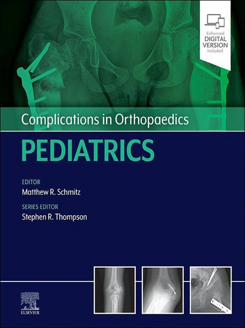 Complications in Orthopaedics: Pediatrics - E-Book - 