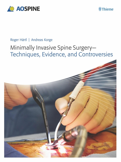 Minimally Invasive Spine Surgery - Techniques, Evidence, and Controversies - Roger Haertl, Andreas Korge