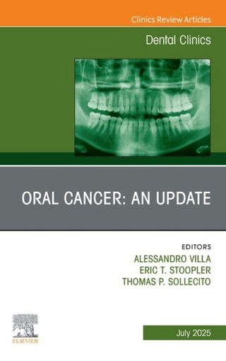 Oral Cancer: An Update, An Issue of Dental Clinics of North America